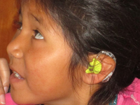 Mädchen mit seinem neuen Hörgerät